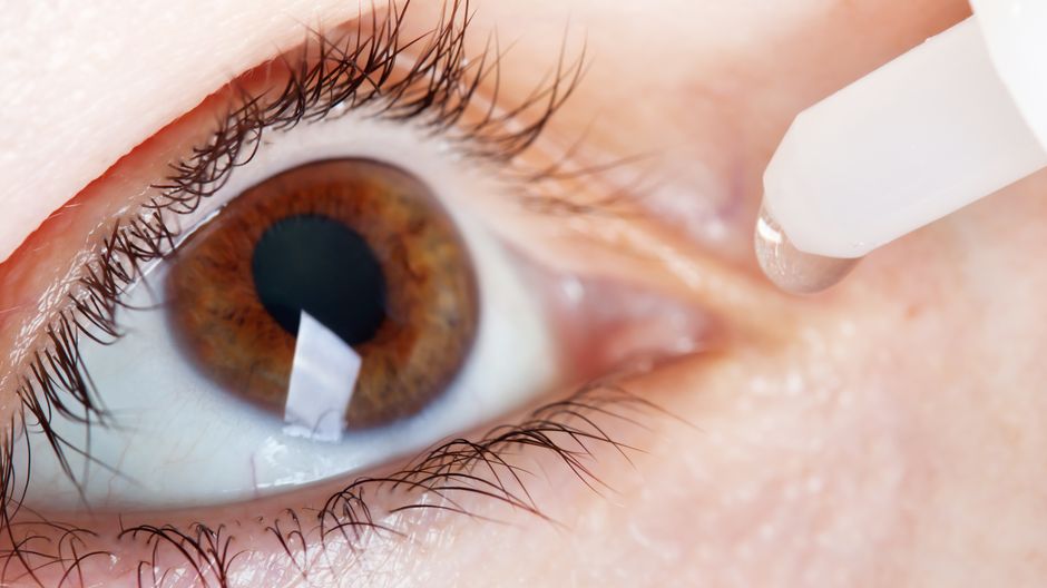 Синдром сухого глаза